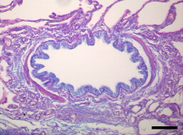 fritzsching-histo-control